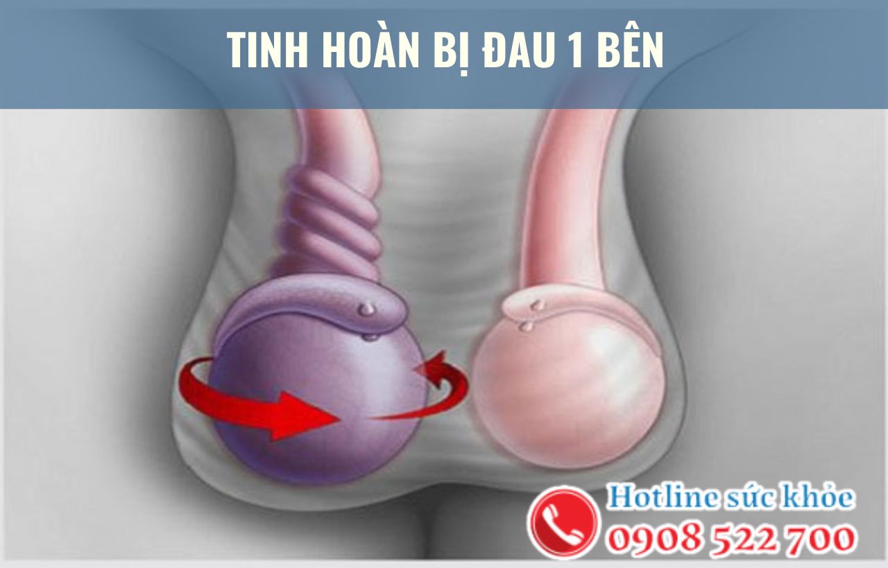 Tinh hoàn bị đau 1 bên có gây vô sinh không?