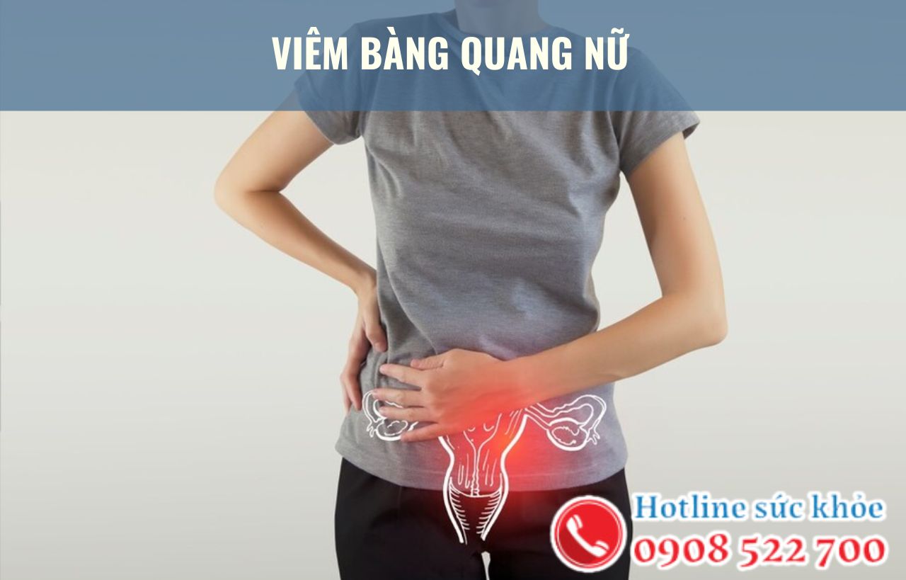 4 Điều cần biết về viêm bàng quang nữ