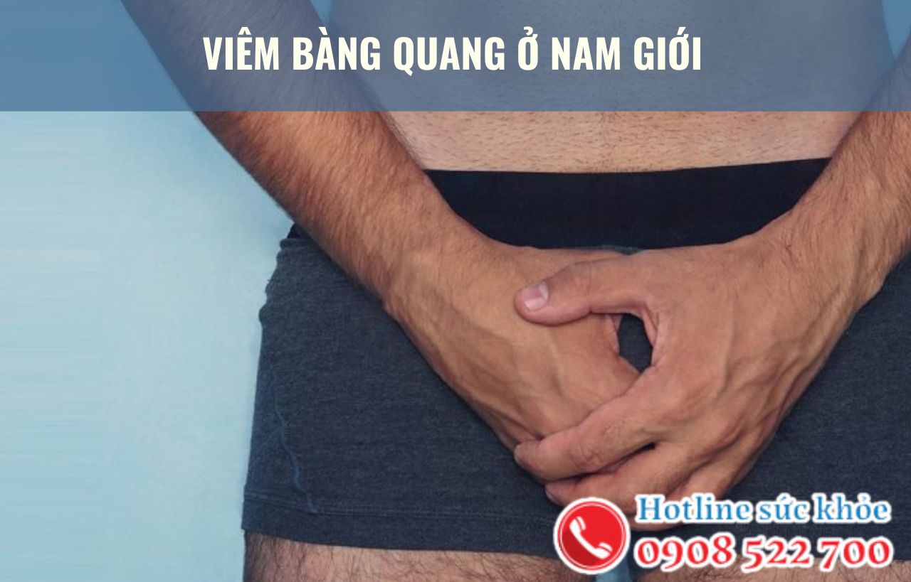 6 Điều cần biết về viêm bàng quang ở nam giới