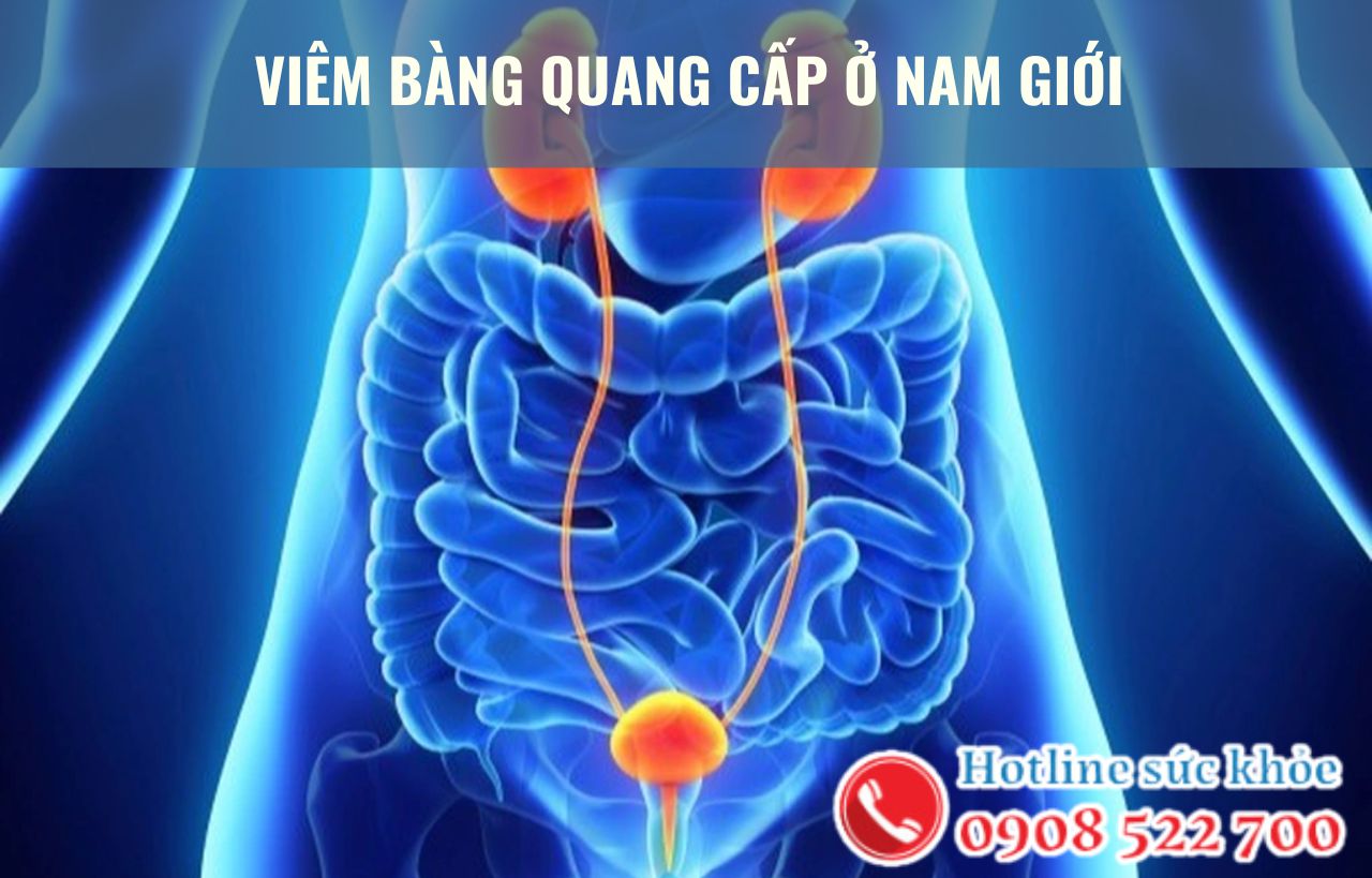 Viêm bàng quang cấp ở nam giới áp dụng phương pháp điều trị nào?