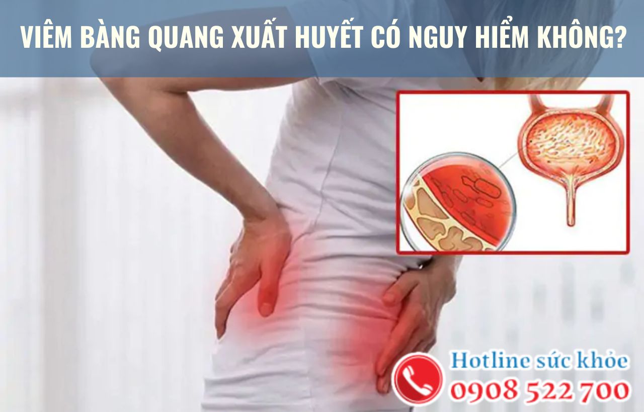 Viêm bàng quang xuất huyết có nguy hiểm không?