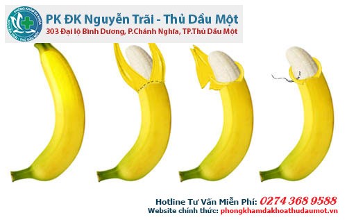 Phương pháp điều trị cắt bao quy đầu truyền thống