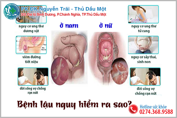 Nguy hại của bệnh lậu đối với sức khỏe của nam và nữ giới