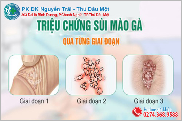 Căn bệnh xã hội nguy hiểm sùi mào gà