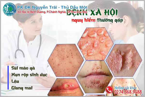 4 loại bệnh xã hội phổ biến dễ mắc phải