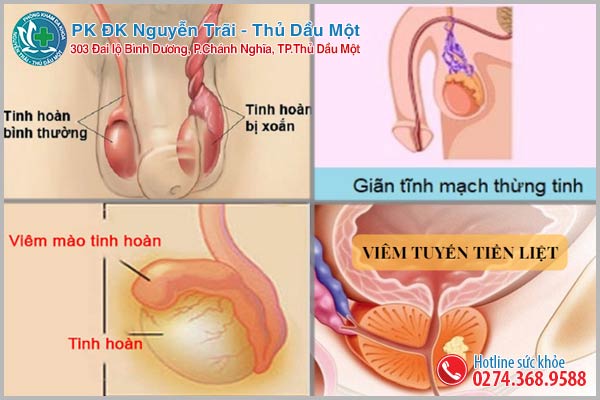 Bệnh về tinh hoàn nam thường gặp