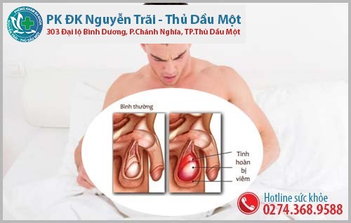 Những biểu hiện của viêm tinh hoàn nam giới không nên bỏ qua