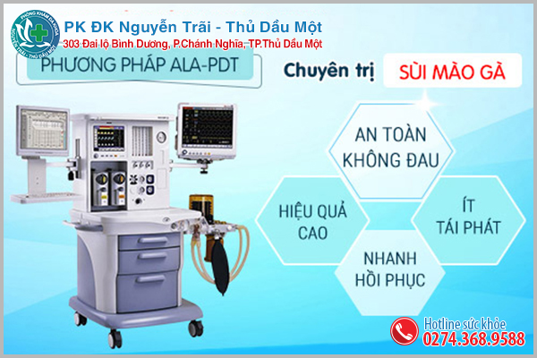 Phương pháp hỗ trợ điều trị sùi mào gà hiện đại ALA-PDT