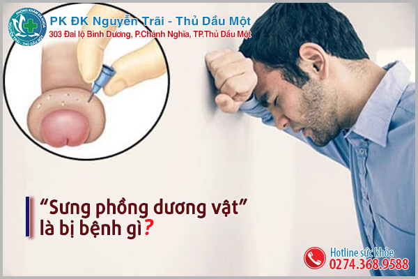 Sưng dương vật - Cảnh báo các bệnh lý nguy hiểm tiềm ẩn