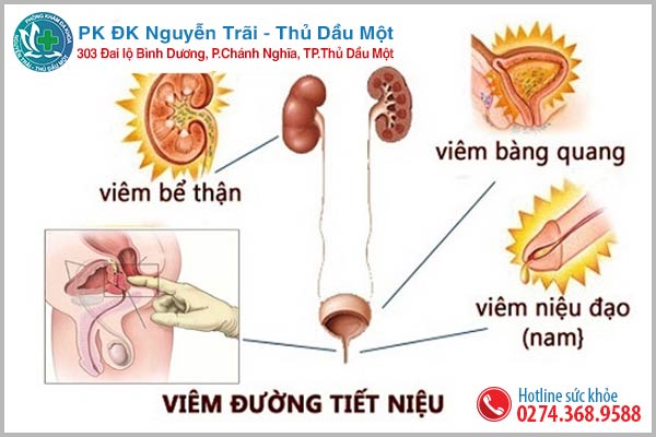 Bệnh về viêm đường tiết niệu ở nam