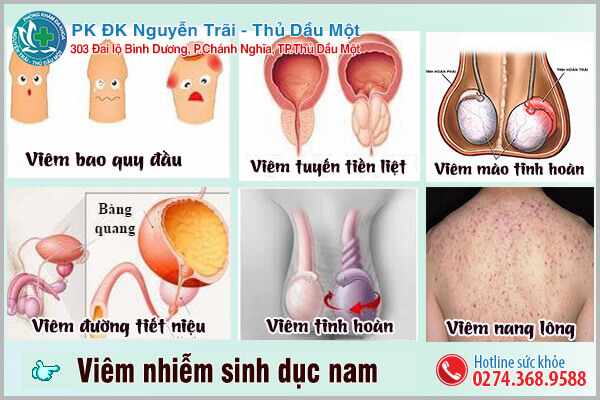 Viêm nhiễm sinh dục nam