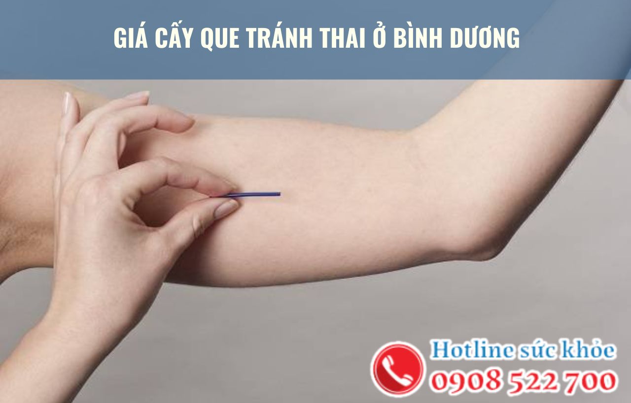 Giá cấy que tránh thai ở Bình Dương bao nhiêu?