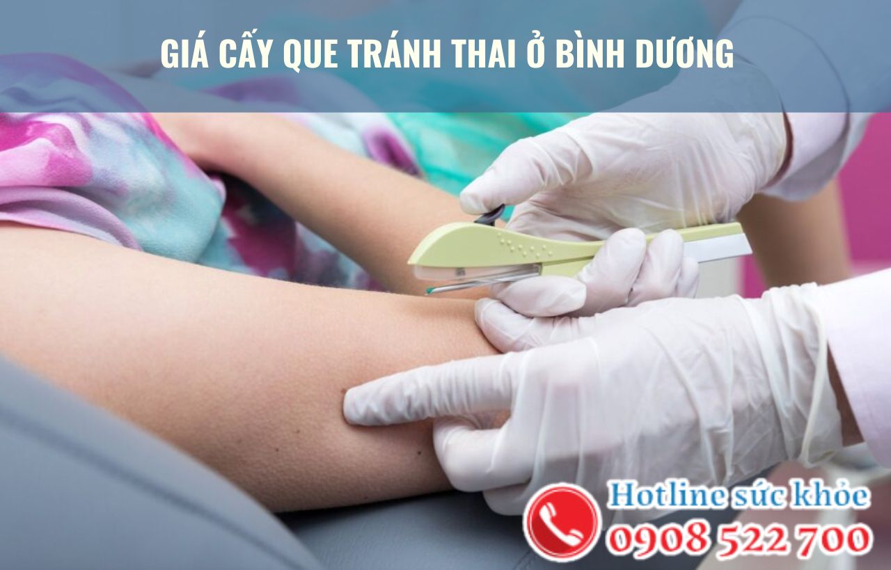 Giá cấy que tránh thai ở Bình Dương bao nhiêu?