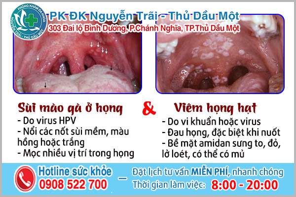 Hình ảnh viêm họng hạt và sùi mào gà thường gặp