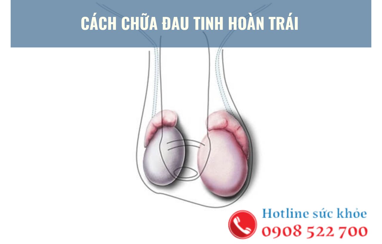 Cách chữa đau tinh hoàn trái tại nhà an toàn?