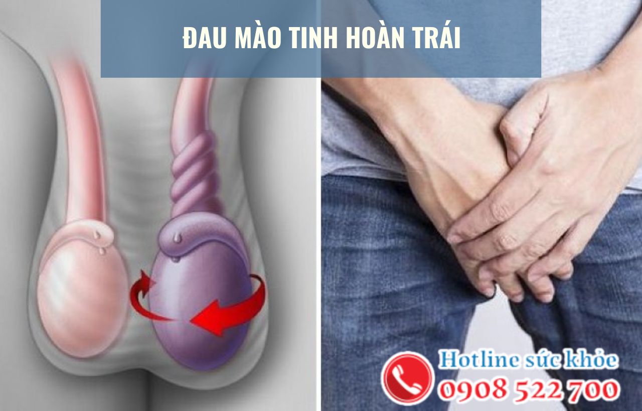 Đau mào tinh hoàn trái là bệnh gì?