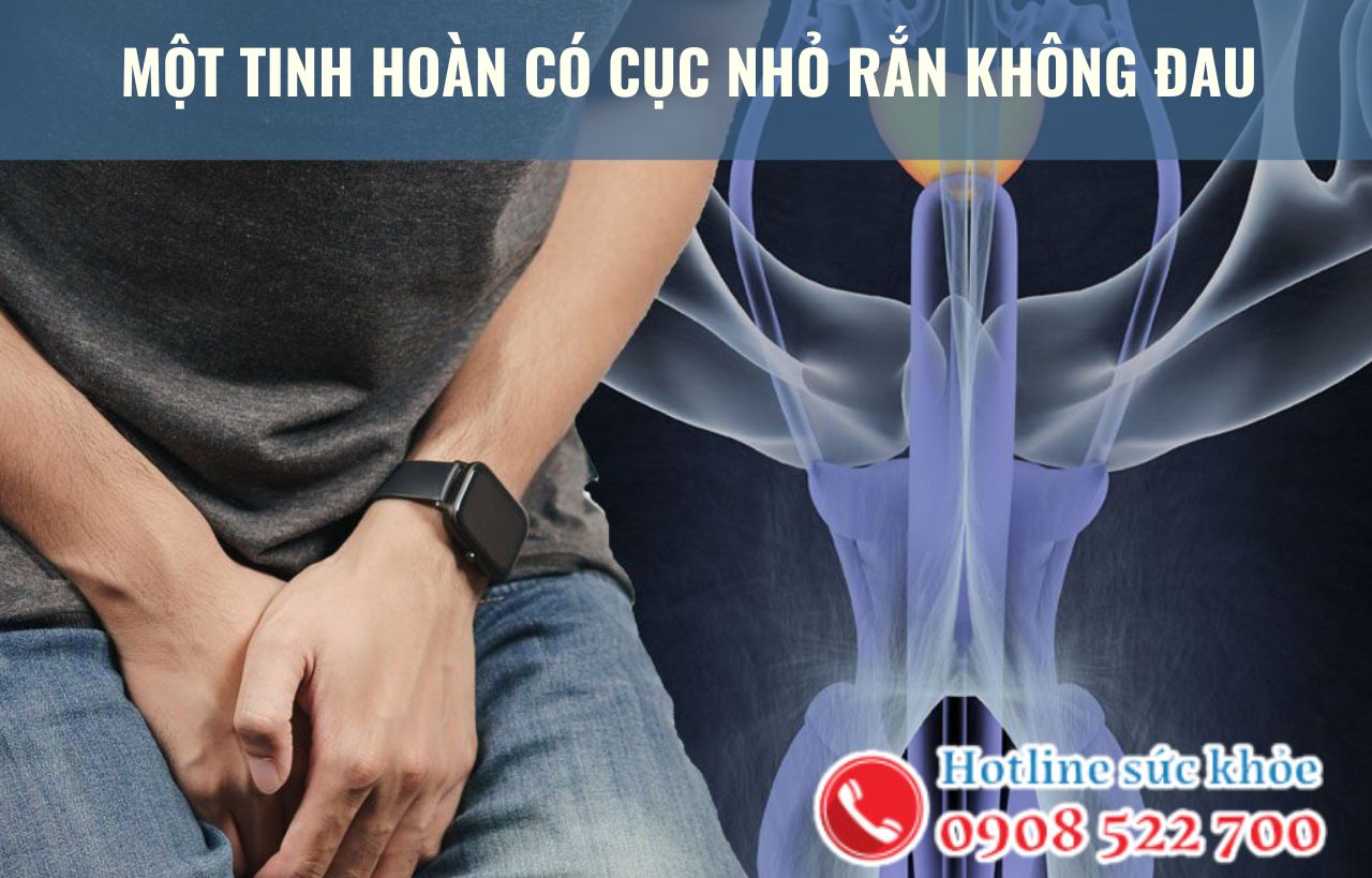 Một tinh hoàn có cục nhỏ rắn không đau có nguy hiểm không?