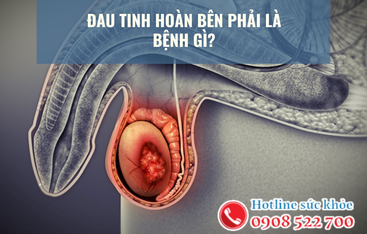 Đau tinh hoàn bên phải là bệnh gì?