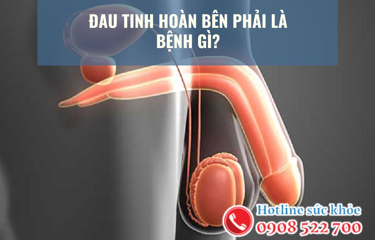 Đau tinh hoàn bên phải là bệnh gì?