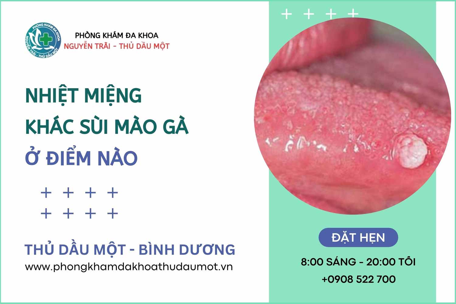 nhiệt miệng và bệnh sùi mào gà khác nhau ở điểm nào