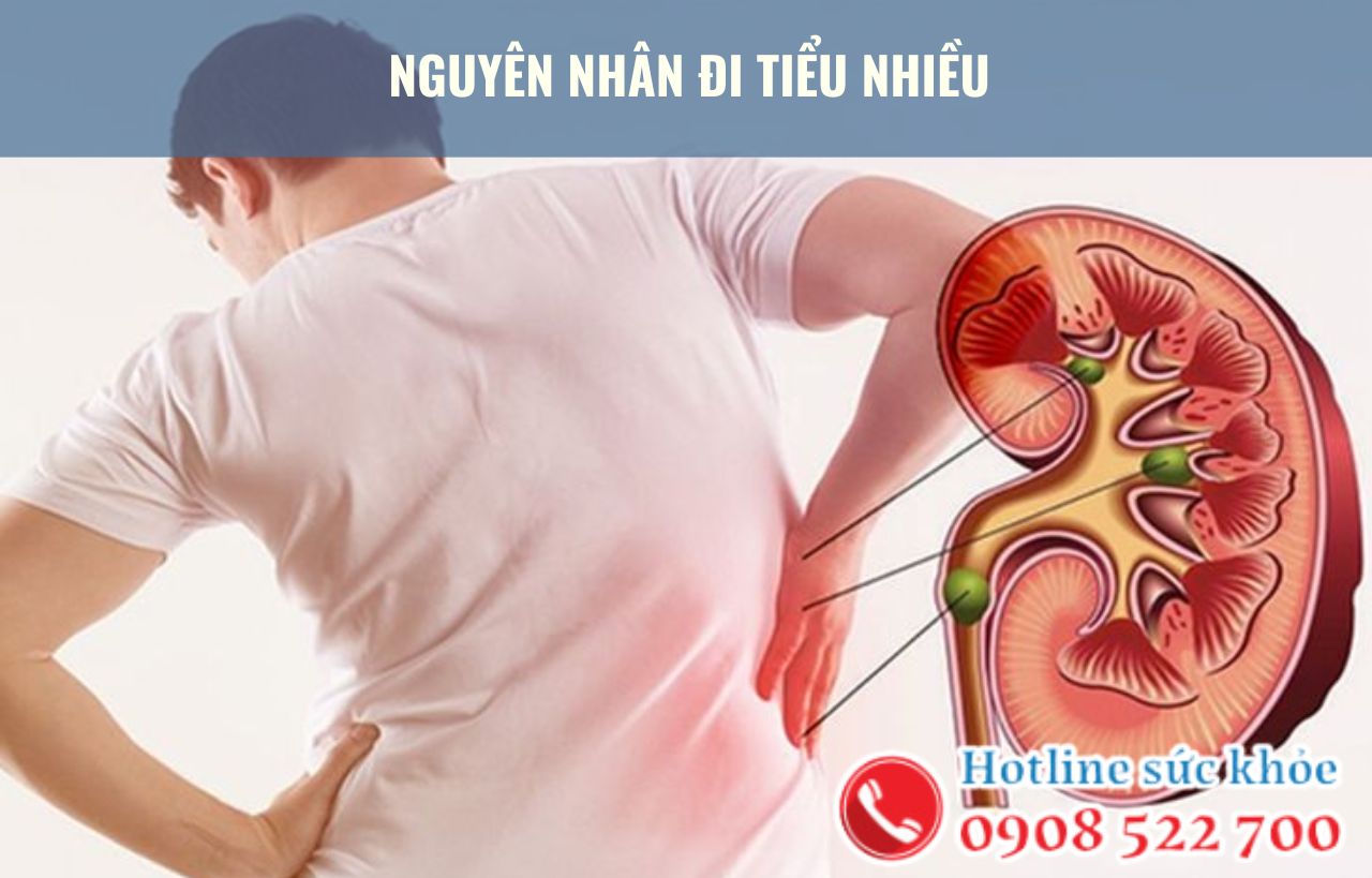 Nguyên nhân đi tiểu nhiều ở nam giới do đâu?