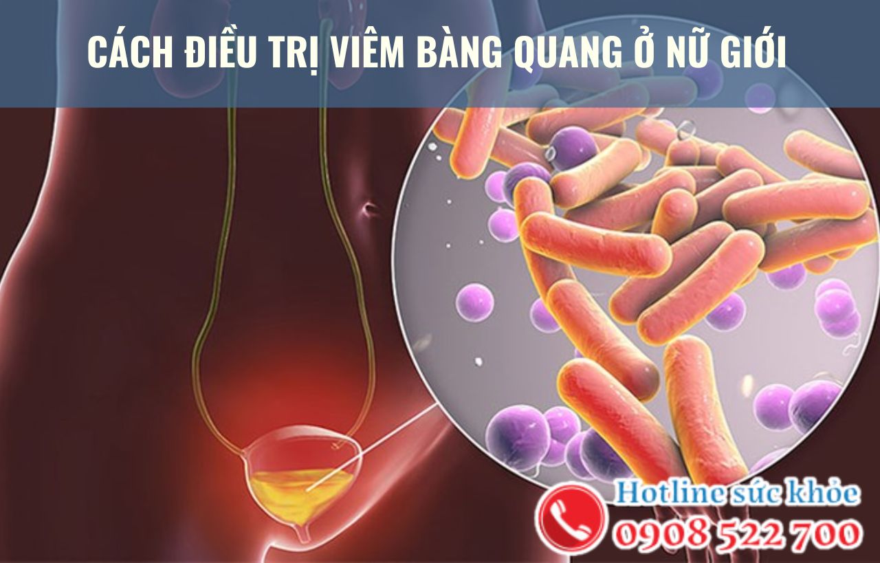 Cách điều trị viêm bàng quang ở nữ giới