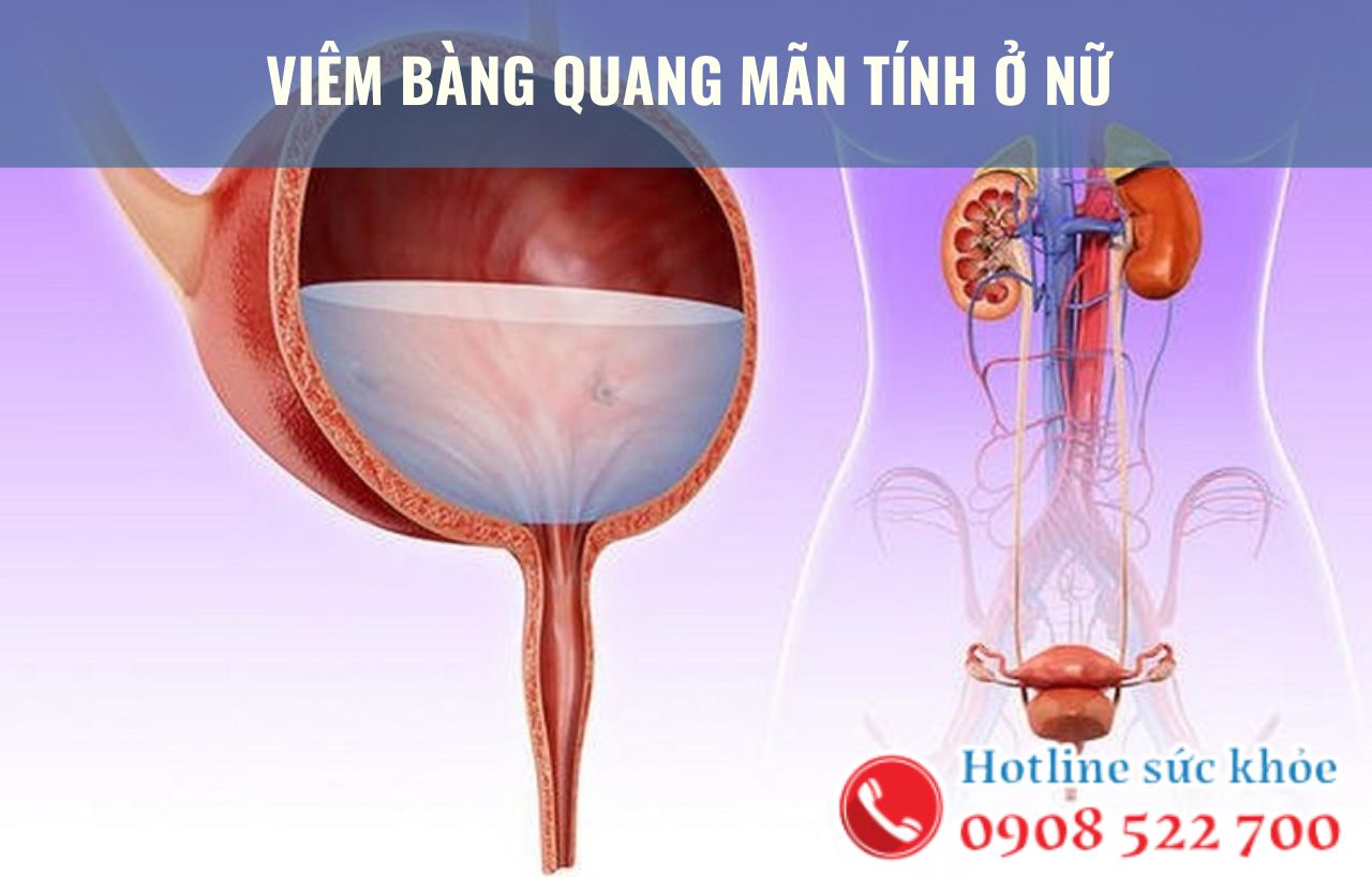 Viêm bàng quang mãn tính ở nữ nguyên nhân do đâu?