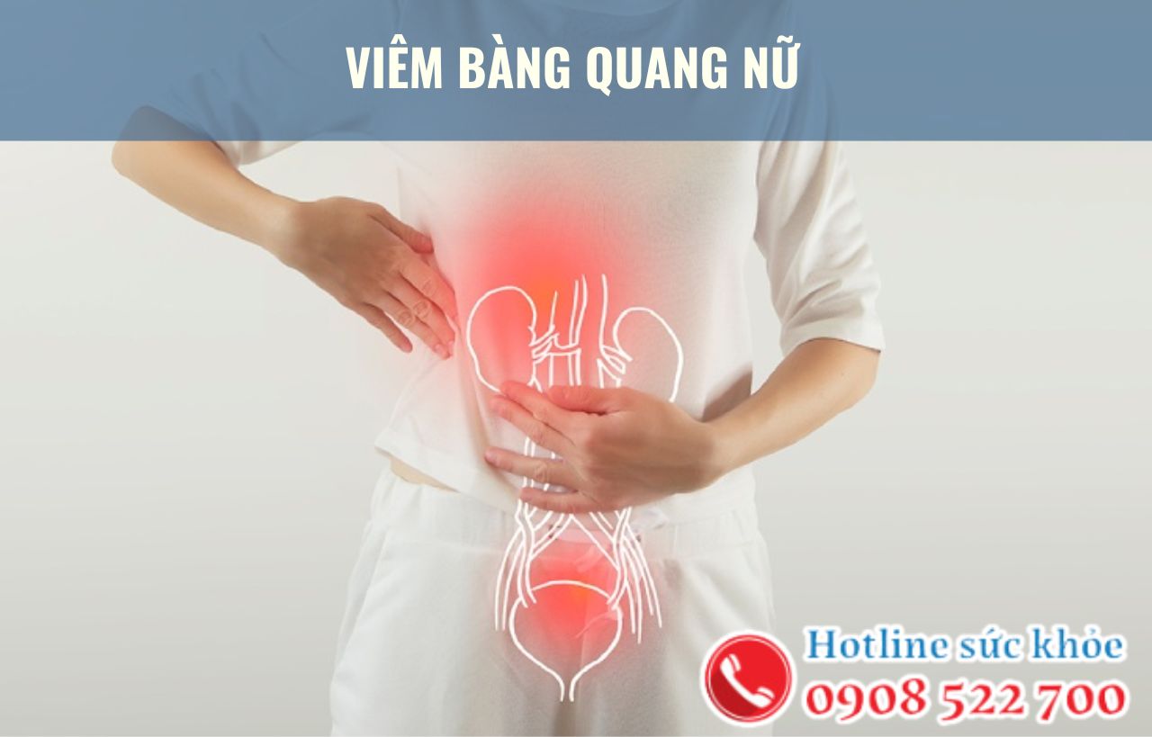 4 Điều cần biết về viêm bàng quang nữ