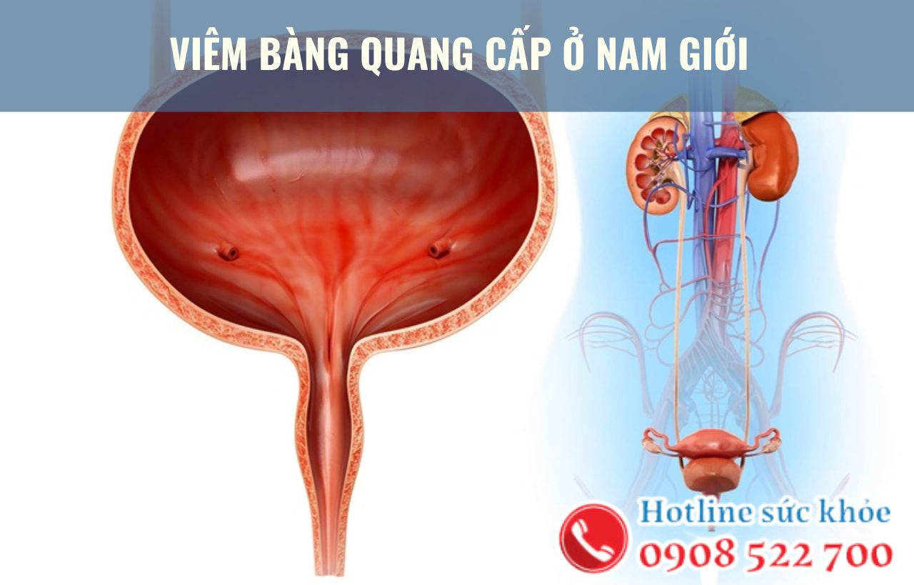 Viêm bàng quang cấp ở nam giới áp dụng phương pháp điều trị nào?