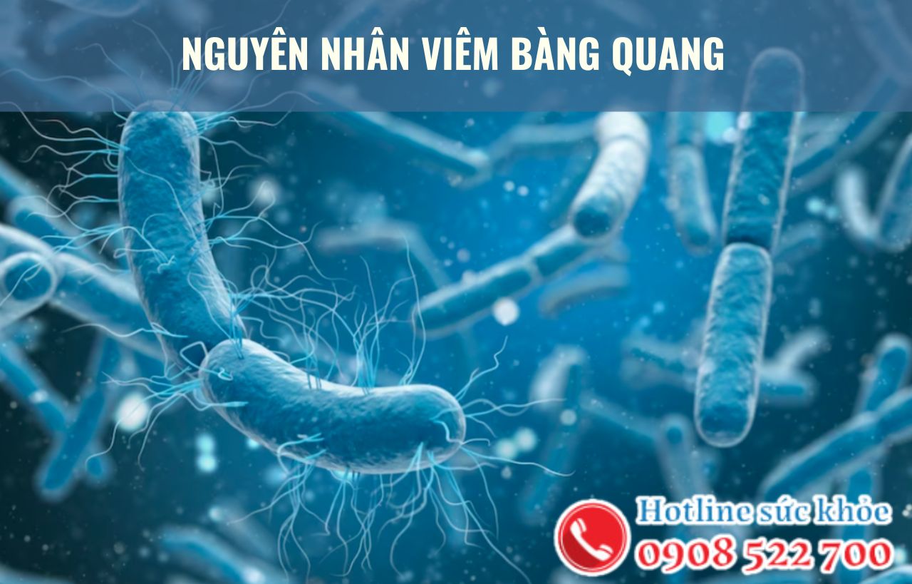 Nguyên nhân viêm bàng quang chủ yếu gây ra bởi yếu tố nào?