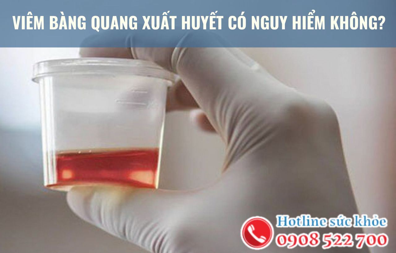 Viêm bàng quang xuất huyết có nguy hiểm không?