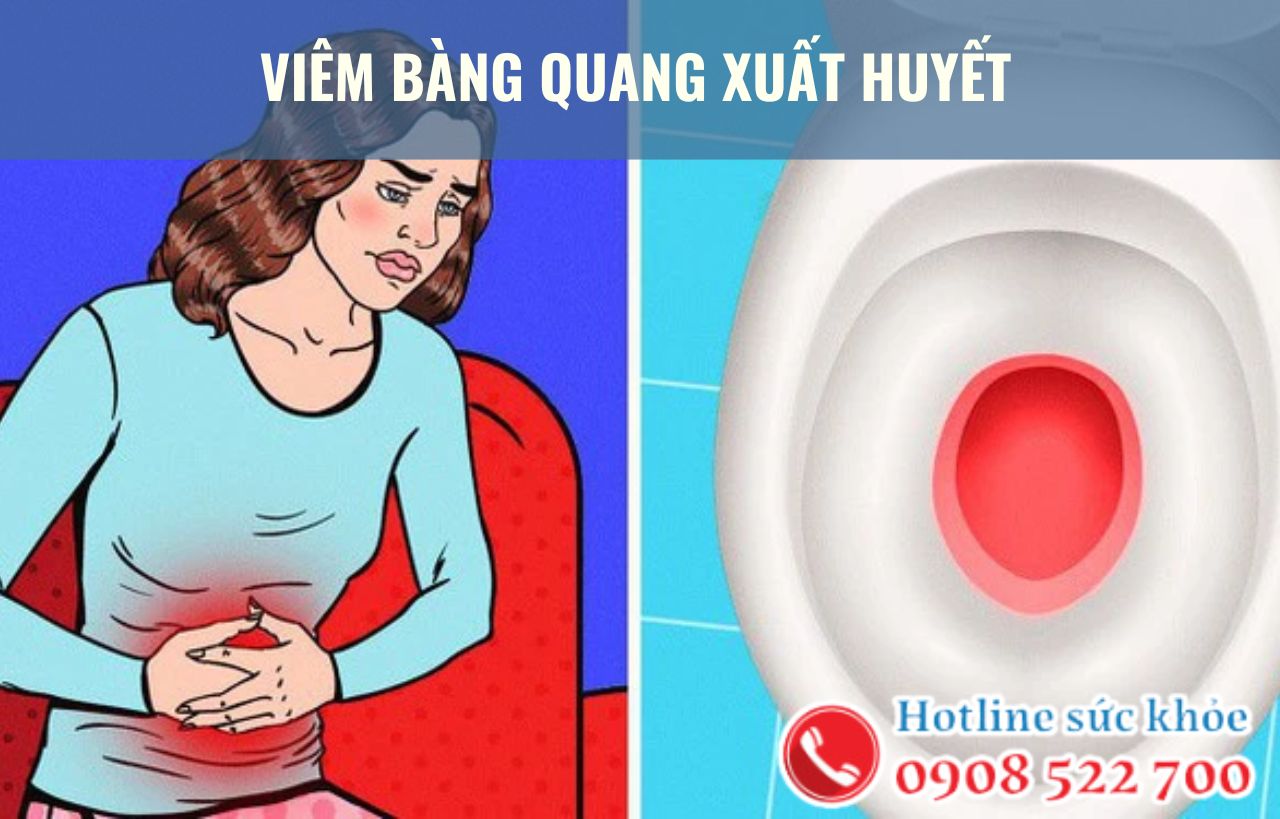 Viêm bàng quang xuất huyết có nguy hiểm không?