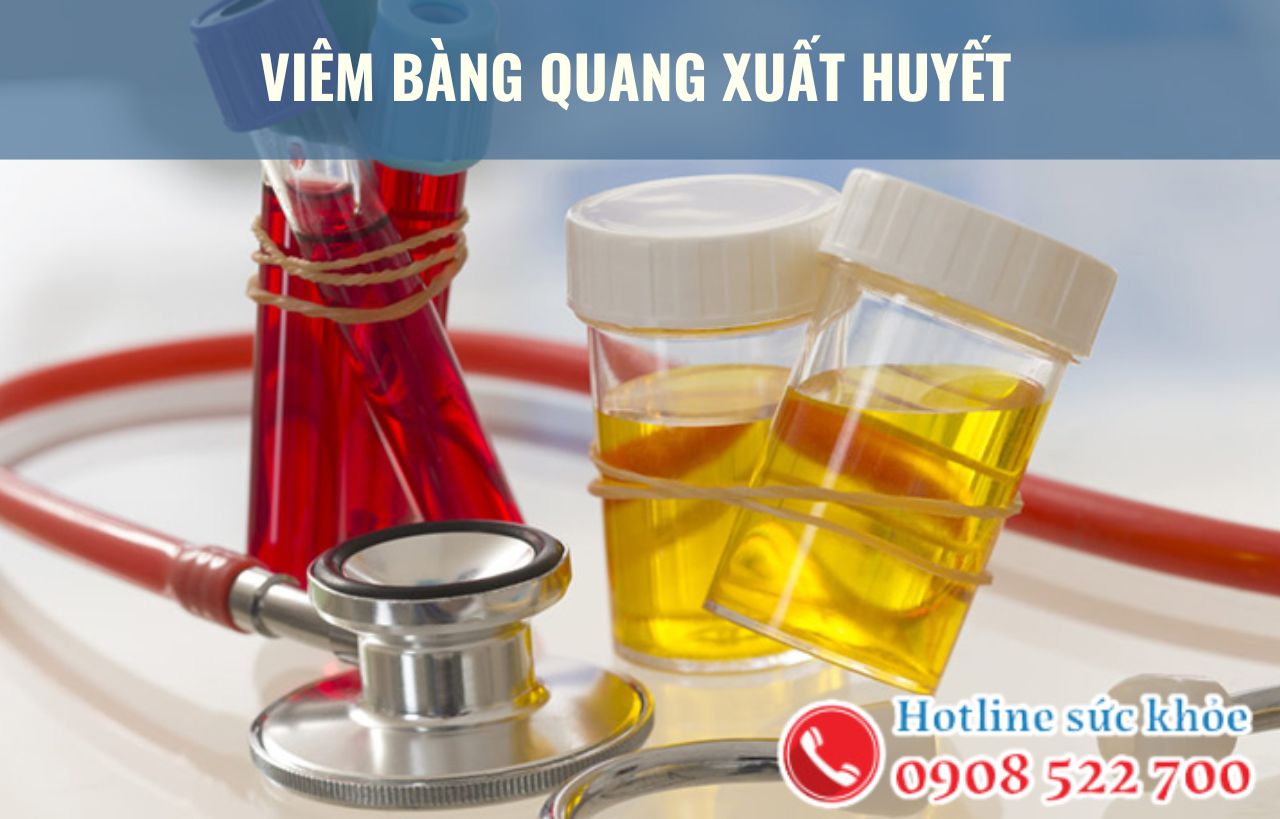 Viêm bàng quang xuất huyết có nguy hiểm không?