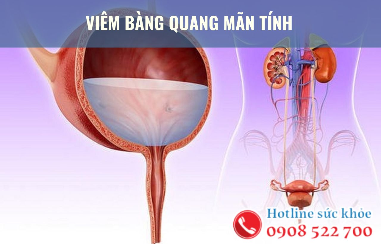 Viêm bàng quang mãn tính có chữa được không?