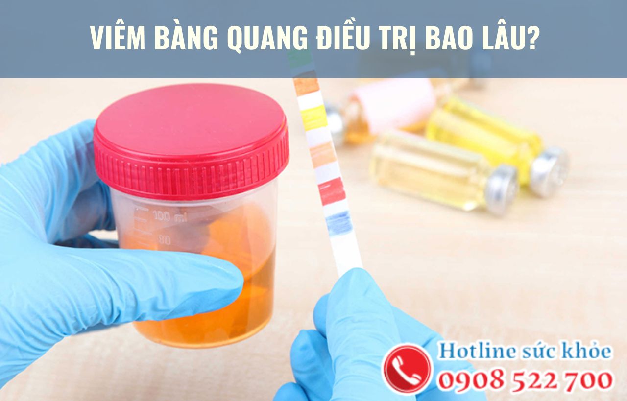 Viêm bàng quang điều trị bao lâu?