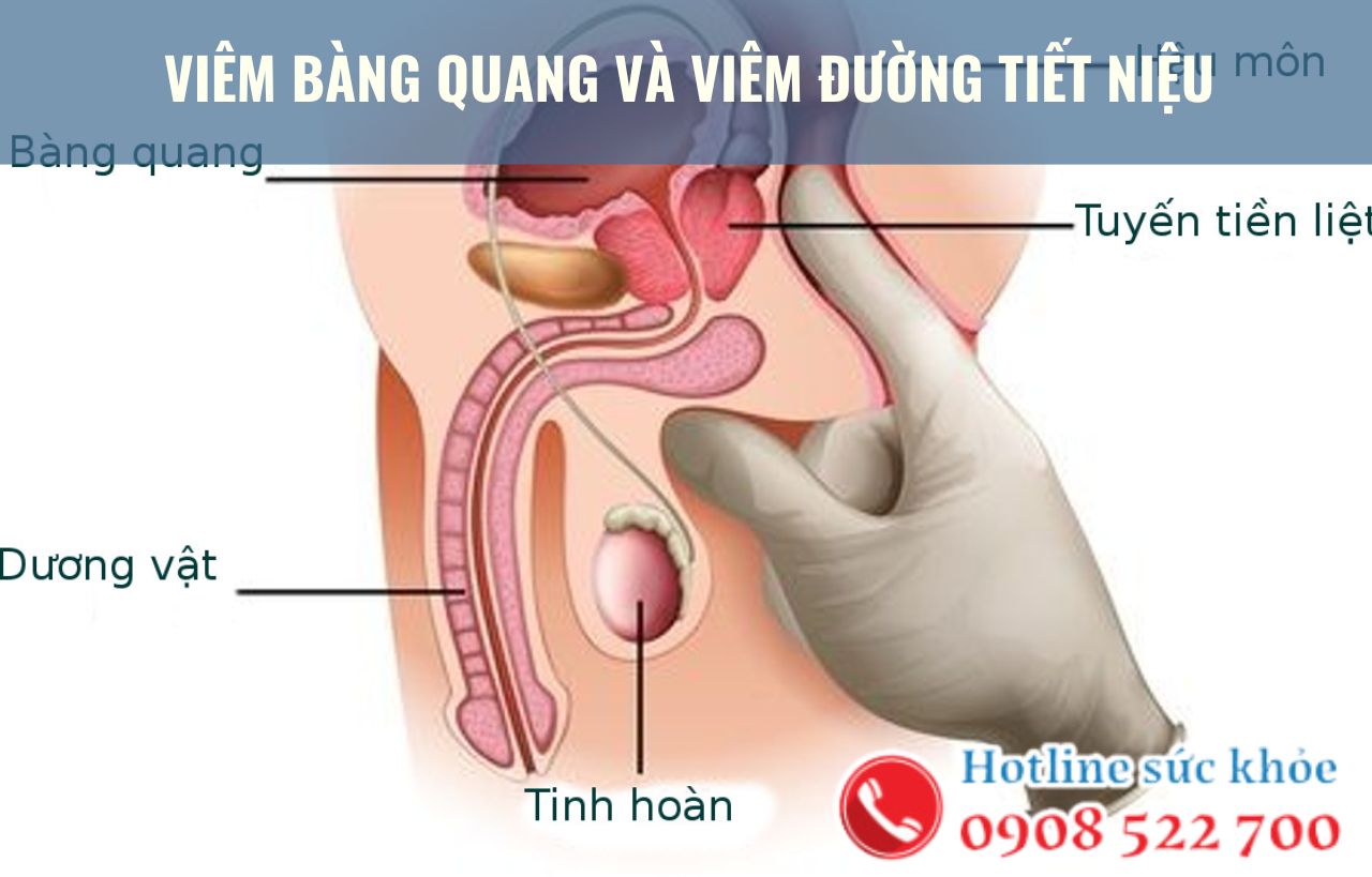 Viêm bàng quang và viêm đường tiết niệu có phải là một?