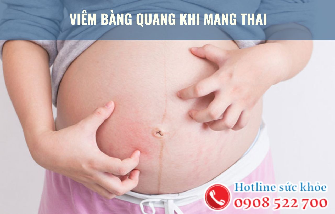 Viêm bàng quang khi mang thai có nguy hiểm?