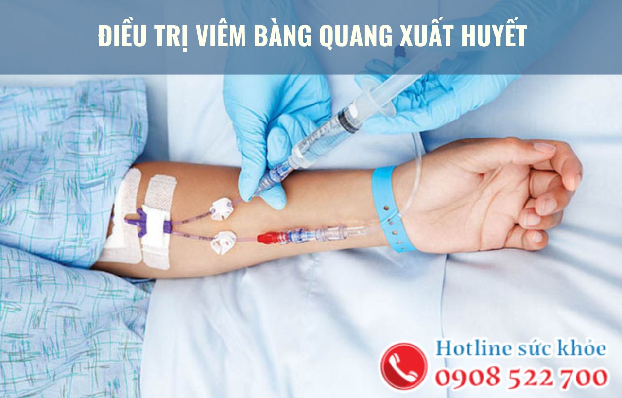 Điều trị viêm bàng quang xuất huyết bằng cách nào?