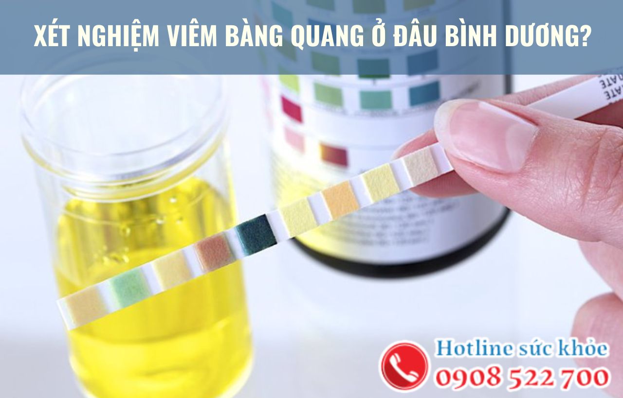 Xét nghiệm viêm bàng quang ở đâu Bình Dương?