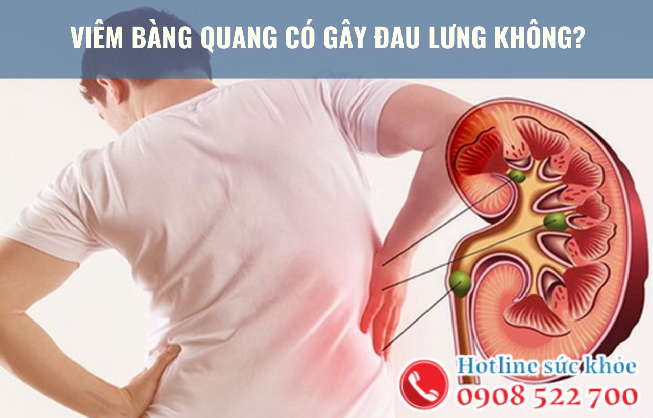 Viêm bàng quang có gây đau lưng không?