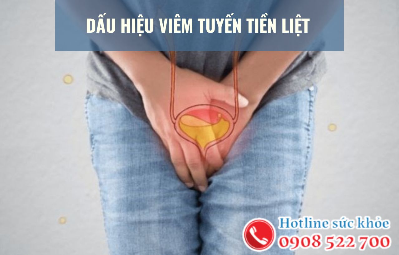 Dấu hiệu viêm tuyến tiền liệt đặc trưng ở nam giới?