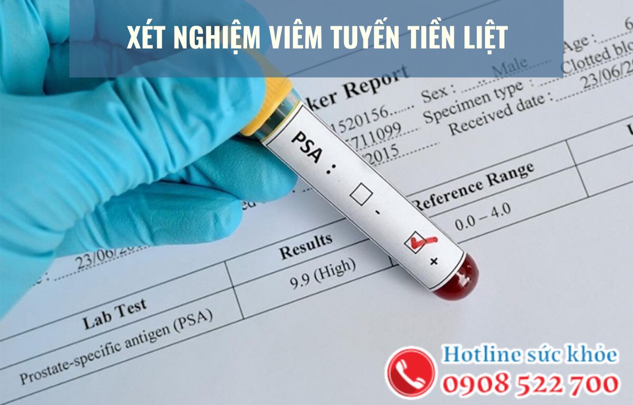 Xét nghiệm viêm tuyến tiền liệt bao gồm?