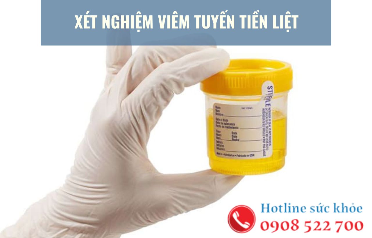 Xét nghiệm viêm tuyến tiền liệt bao gồm?