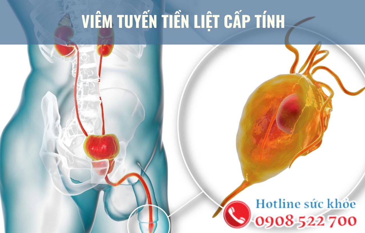 Viêm tuyến tiền liệt cấp tính có nguy hiểm không?