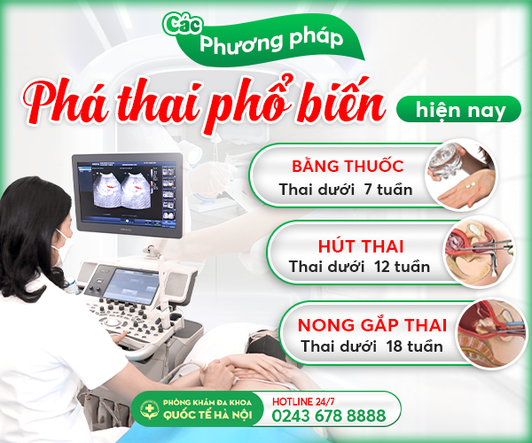 Thông tin chi tiết về kinh nghiệm phá thai bằng thuốc