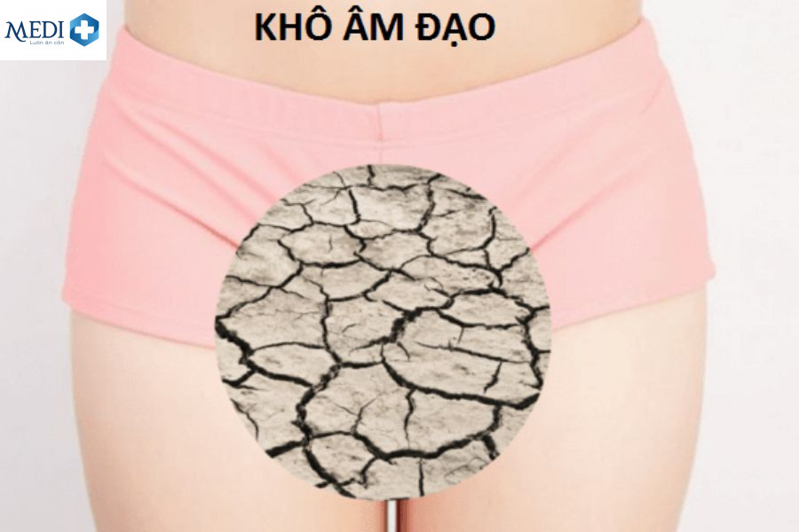 Thông tin chi tiết về quan hệ bị đau rát