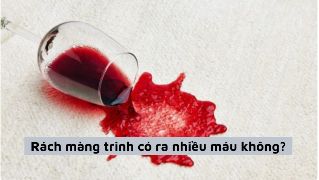 Thông tin chi tiết về màng trinh không lỗ thủng