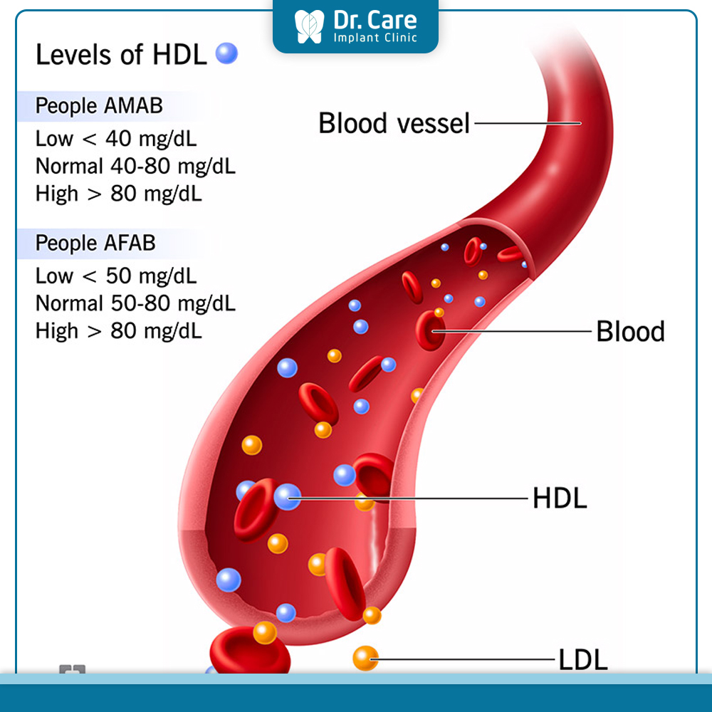Hình ảnh minh họa hdl cholesterol là gì