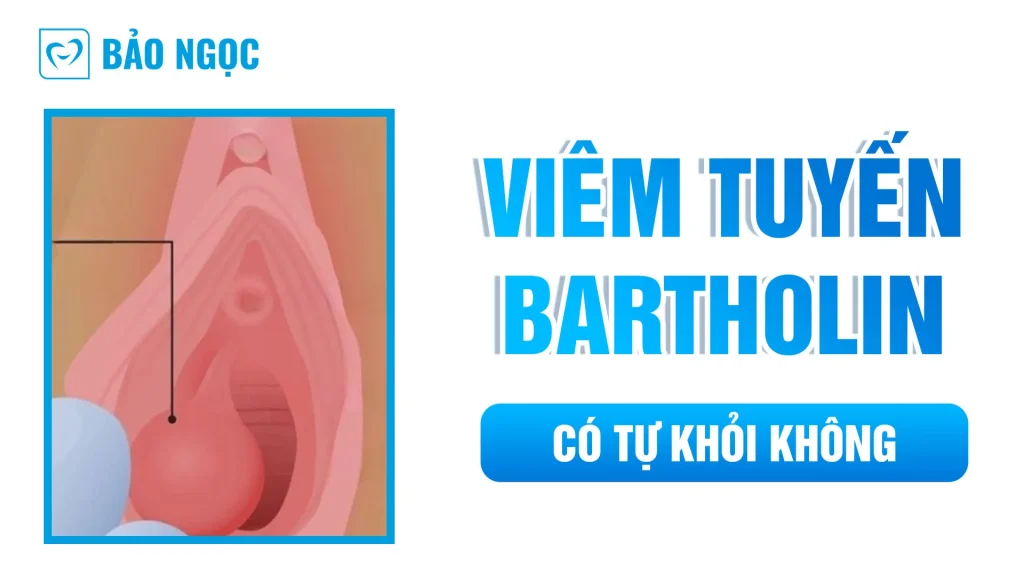 địa chỉ chữa viêm tuyến bartholin