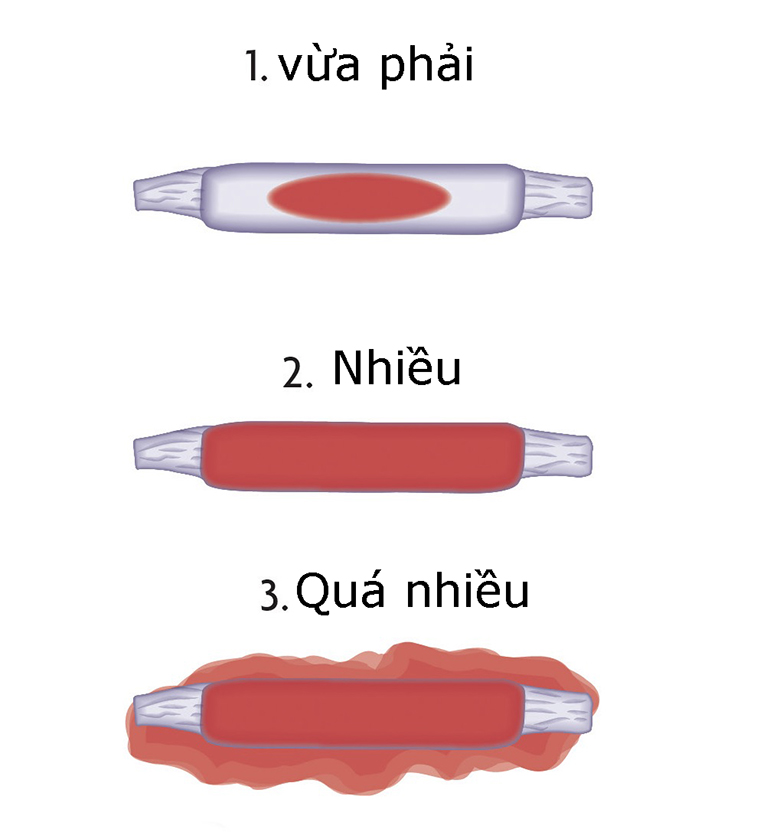 Thông tin chi tiết về cách phá thai tự nhiên